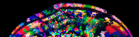 Multi-color dots possibly cell membrane