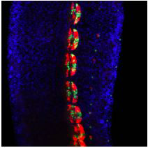 Transgenic Helobdella